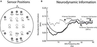 Advancing Our Understandings of Healthcare Team Dynamics From the Simulation Room to the Operating Room: A Neurodynamic Perspective